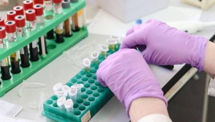 SMA hastal??? nedir, belirtileri neler? 