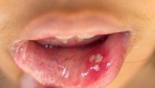 Uu?un kkn kurutuyor! 